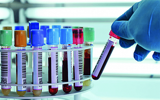 Глистная инвазия